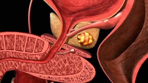 Prostamin Forte resultados reales